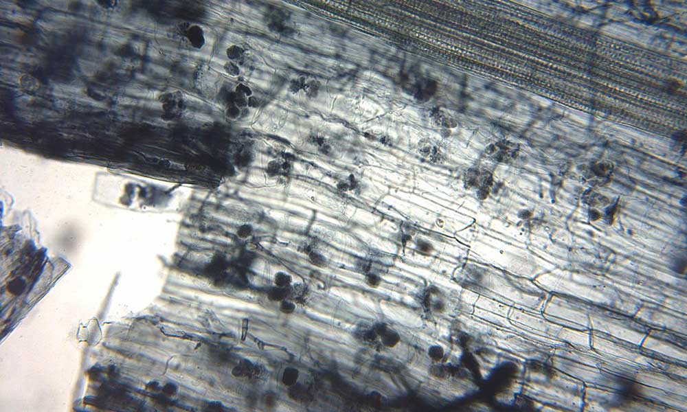 Closeup of Mycorrhizae Fungi Forming Arbuscular Growths